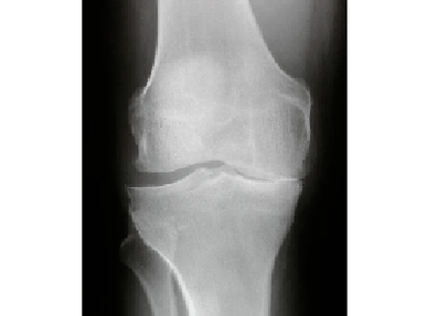Diagnosis of knee joints