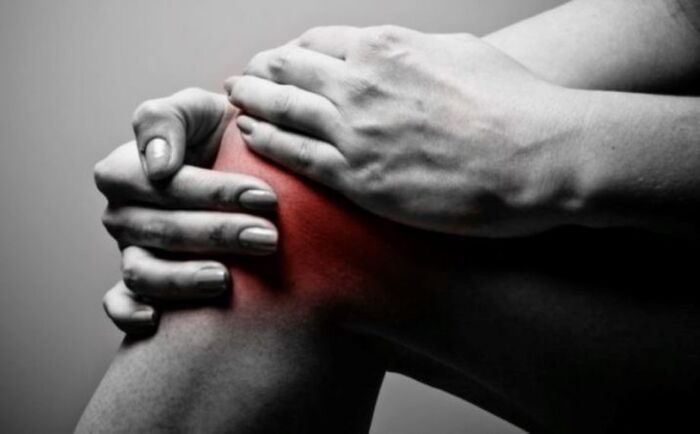 Arthritis