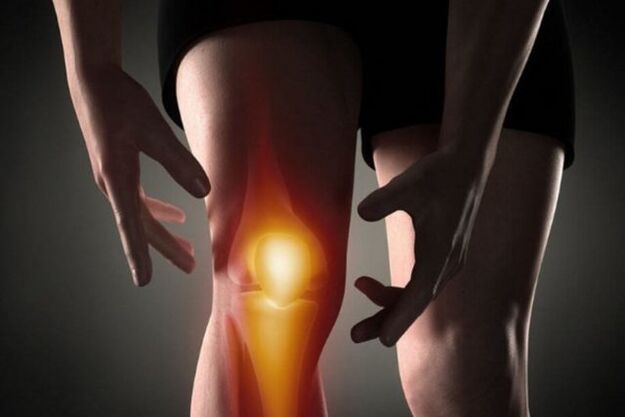 Knee arthritis