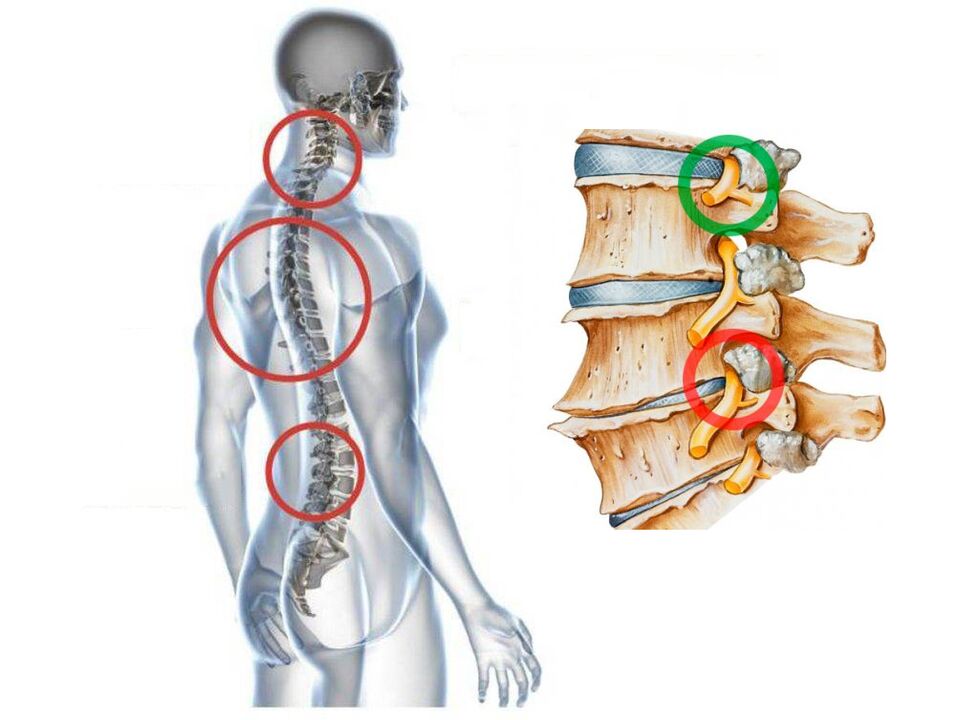 What does the cervical vertebrae look like