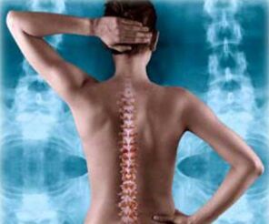 Back spine illustration