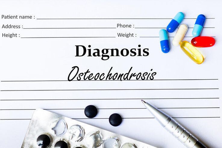 Drugs to Diagnose Osteochondrosis